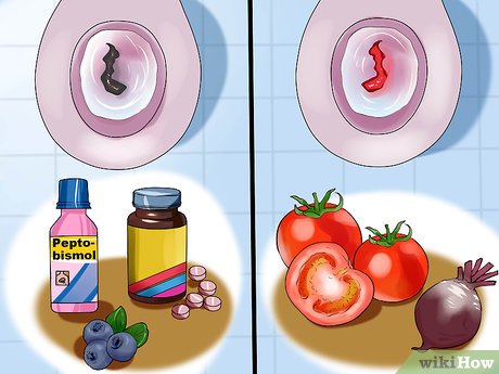 erros ao tratar sangue nas fezes com chás