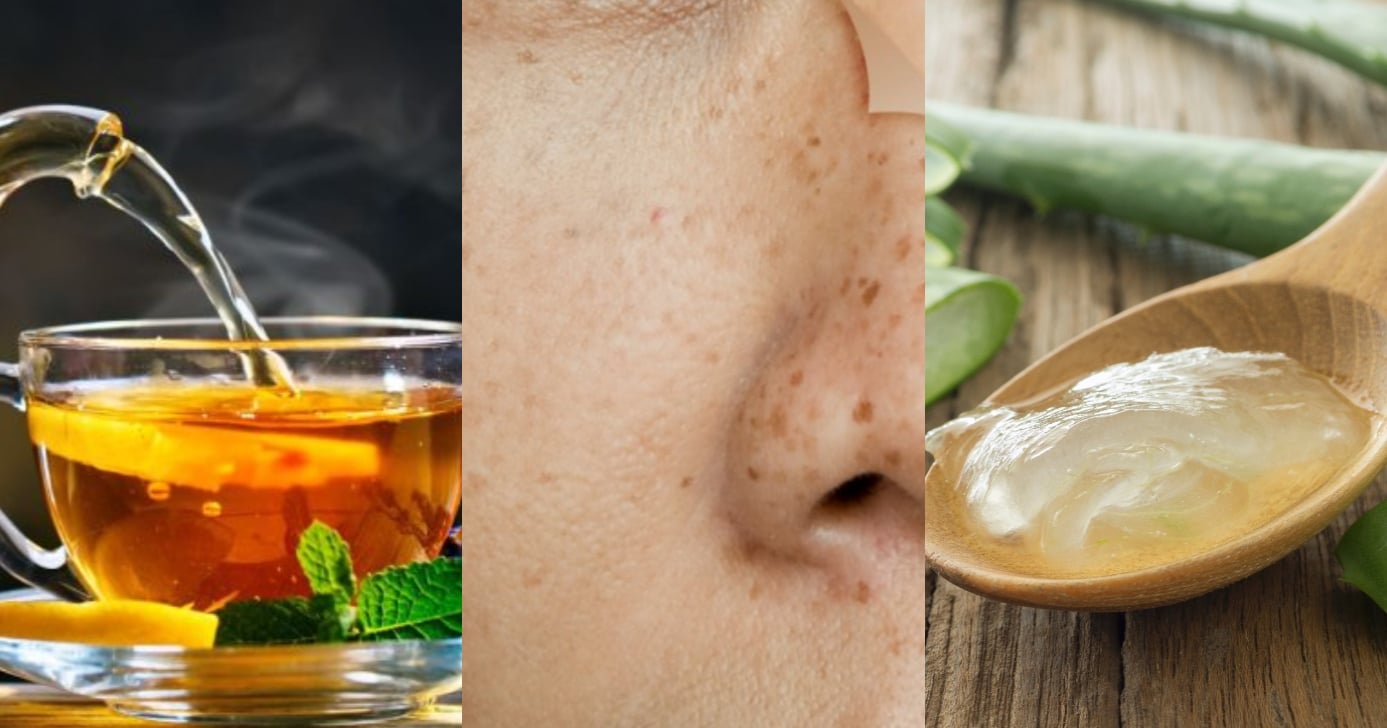 tratamento natural manchas rosto